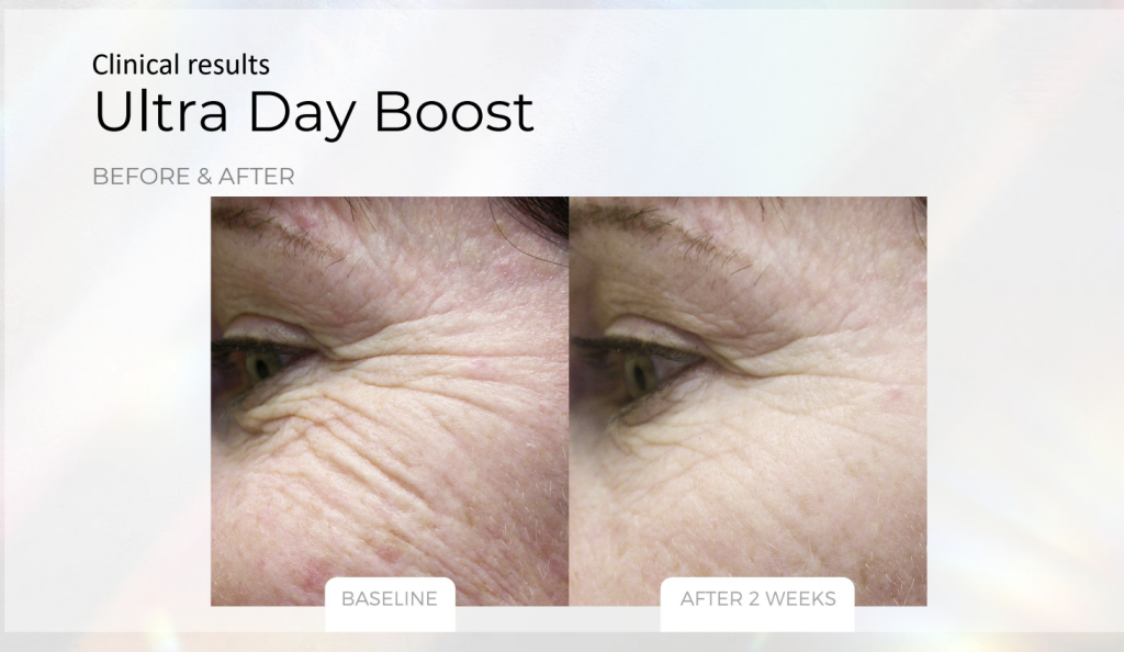 Ultra Day Boost – product details, medical-grade skincare by Zahav Medspa